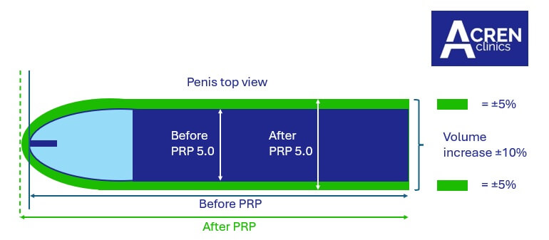 priapus-shot treatment