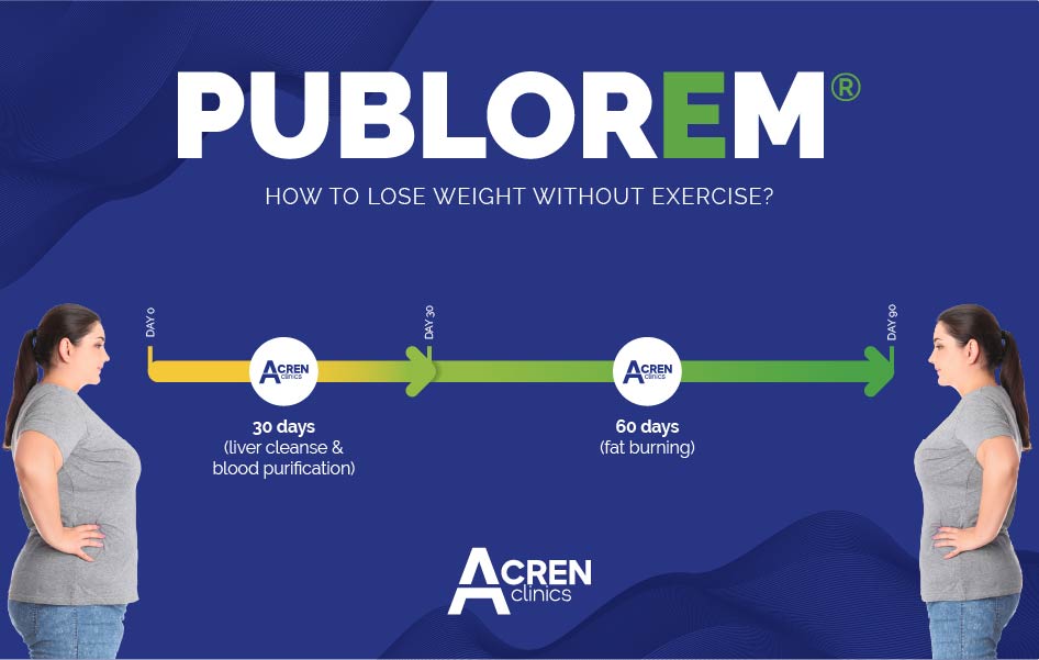 How to lose weight without exercise